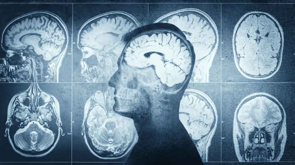 Nace el proyecto SafeICP para crear un monitor inteligente para medir la presión intracraneal de forma no invasiva