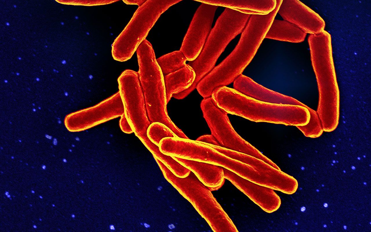 Investigadores del CSIC ponen a prueba el método para predecir la resistencia a antibióticos en la tuberculosis