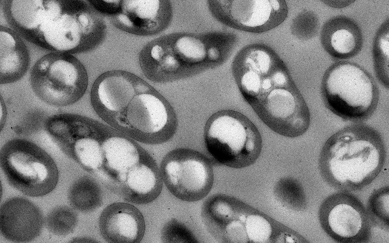 Diseñan factorías bacterianas para producir bioplásticos a partir de plásticos convencionales