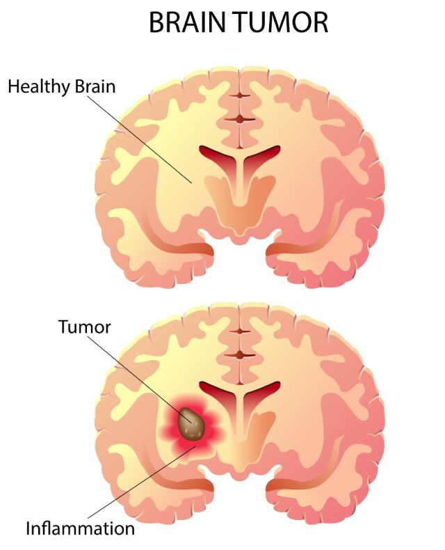 17_smarthealth