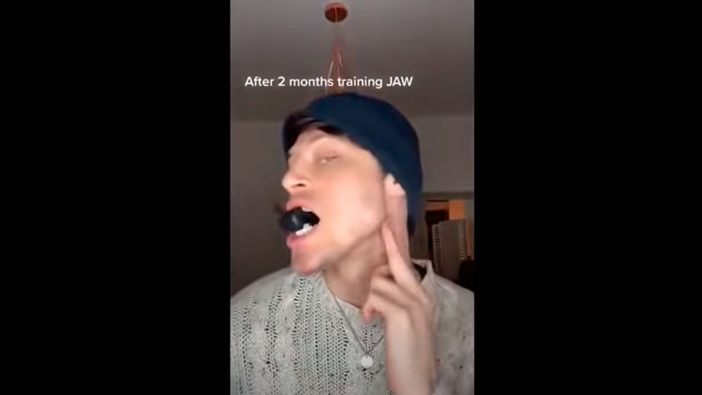 La moda en redes sociales de ejercitar la mandíbula pone en peligro la articulación temporomandibular