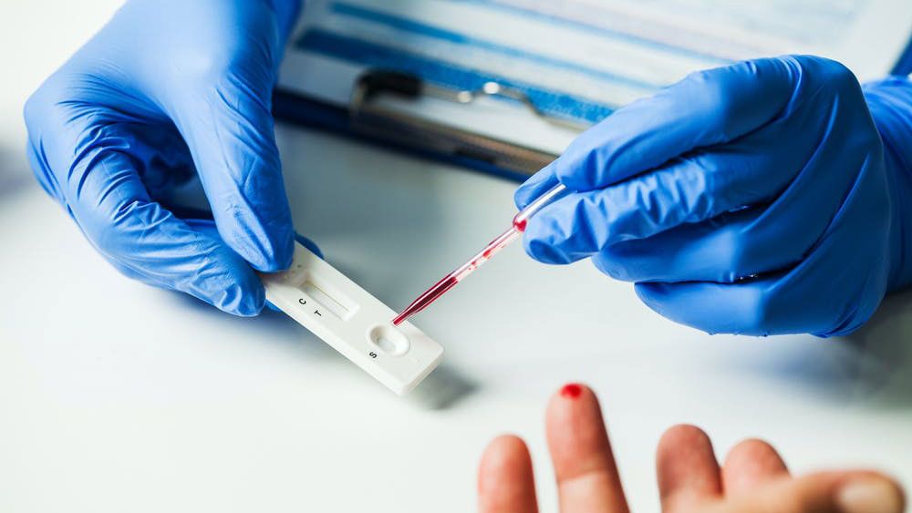 La venta de test de antígenos en farmacias podría haber llegado tarde para España 