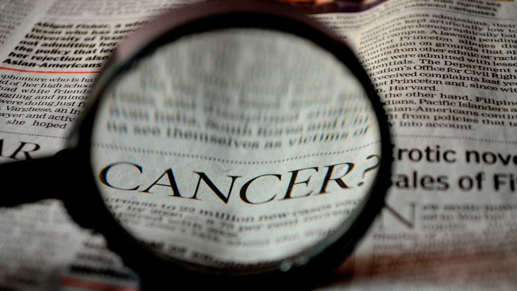 El proyecto OPTIMA busca mejorar el tratamiento para el cáncer de próstata, mama y pulmón aplicando tecnologías de vanguardia