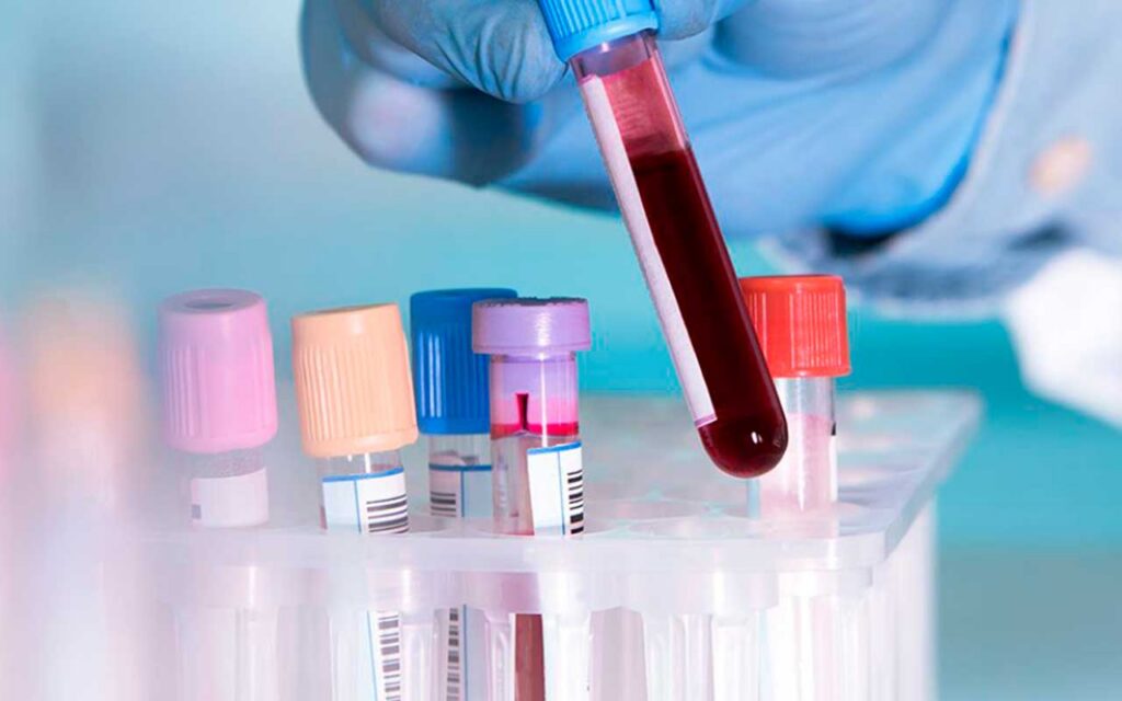 New test can identify if a patient has cancer and if it has spread
