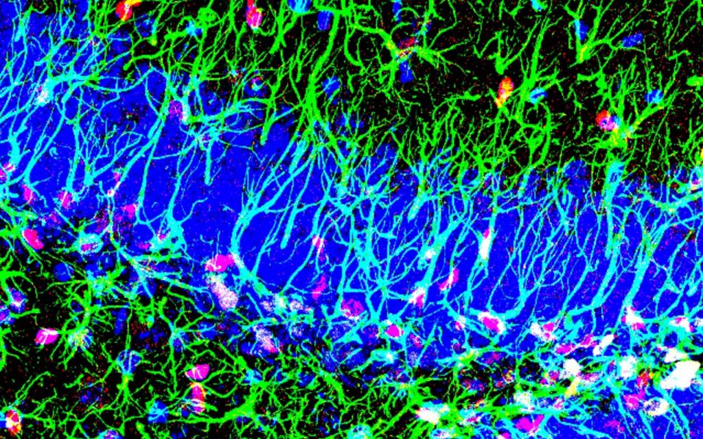 Descubierto un nuevo mecanismo para activar las células madre del cerebro adulto