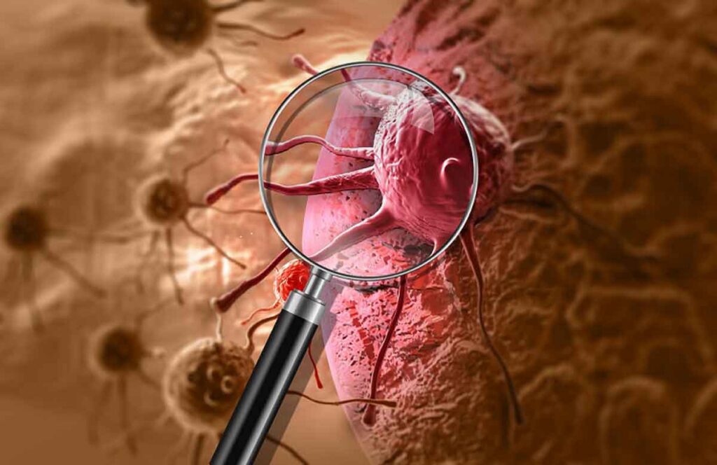 M²OLIE’s goal is to turn cancer into a chronic disease