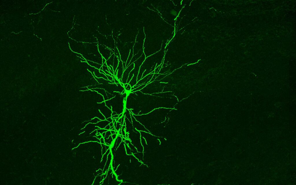 Una sonda que emplea la luz para el diagnóstico de patologías cerebrales