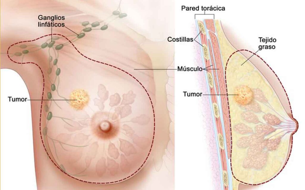Vall d’Hebron y el Tibidabo celebran un acto para visibilizar que el cáncer de mama diagnosticado durante el embarazo se puede tratar