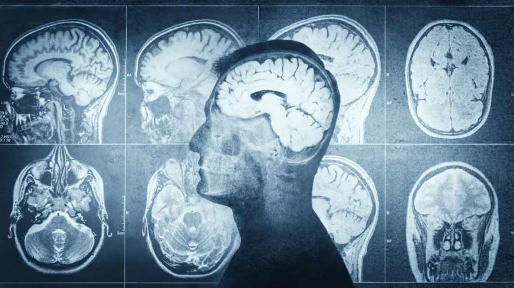 Nace el proyecto SafeICP para crear un monitor inteligente para medir la presión intracraneal de forma no invasiva