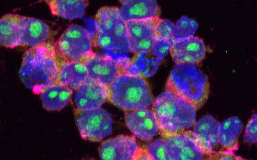 Nanocápsulas con control remoto para amplificar localmente el efecto de las quimioterapias