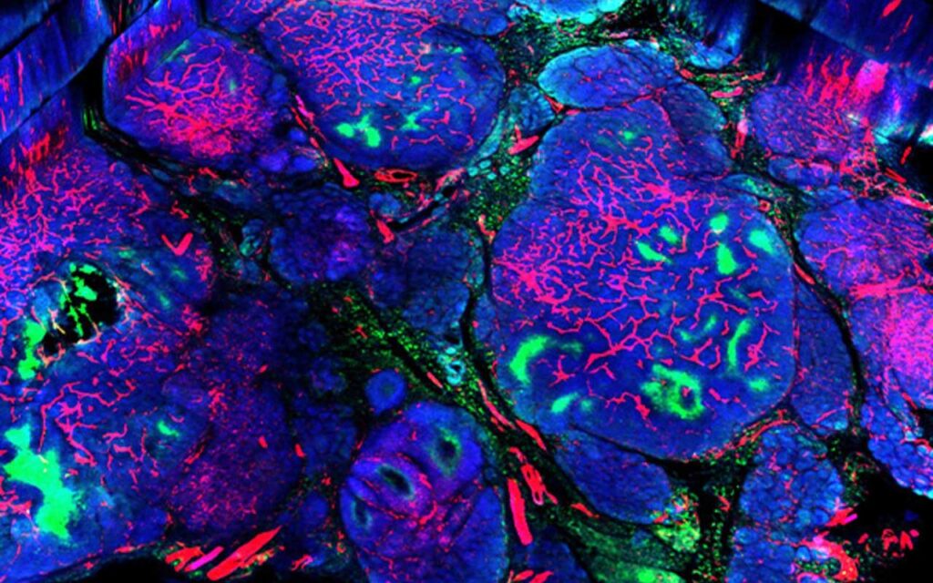 Identifican nuevos compuestos bioactivos que podrían ayudar en la lucha contra el cáncer de mama