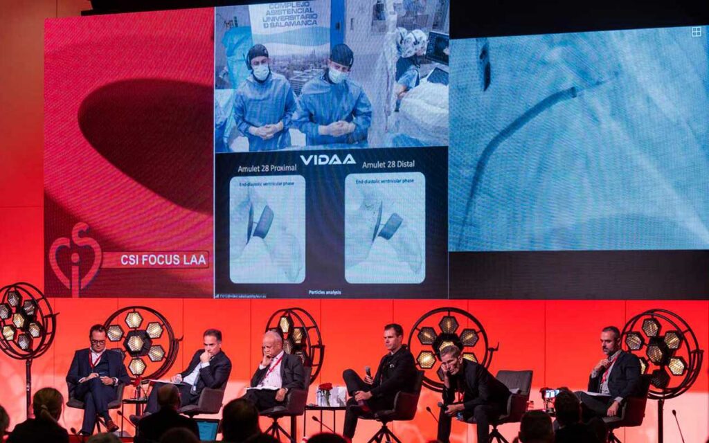 VIDAA: Innovación pionera en cirugía cardíaca en el Congreso CSI LAA Focus de Frankfurt utilizando un corazón virtual