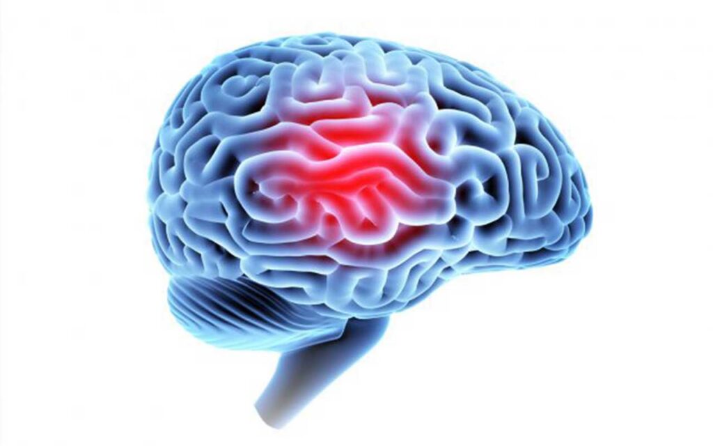 A win for science, and patients, against brain injury ‘nihilism’