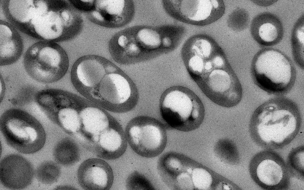 Diseñan factorías bacterianas para producir bioplásticos a partir de plásticos convencionales