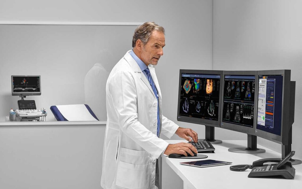 Tecnología de vanguardia para la salud cardiovascular: desde el diagnóstico temprano hasta el seguimiento post-intervención