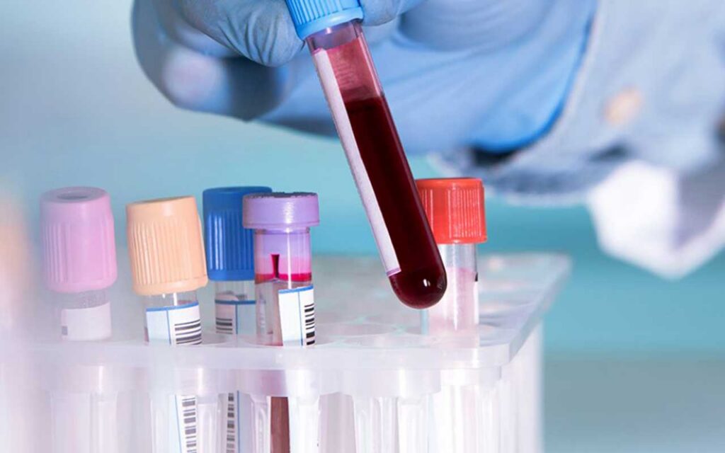 Oxford researchers develop blood test to enable early detection of multiple cancers