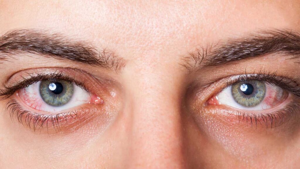 Desarrollan un nuevo colirio para el tratamiento simultáneo del glaucoma y la enfermedad de ojo seco