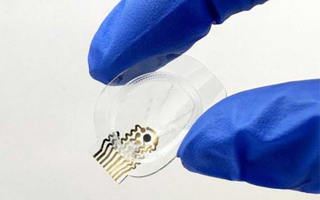Microfluidic smart bandage monitors chronic wounds and accelerates healing with real-time data