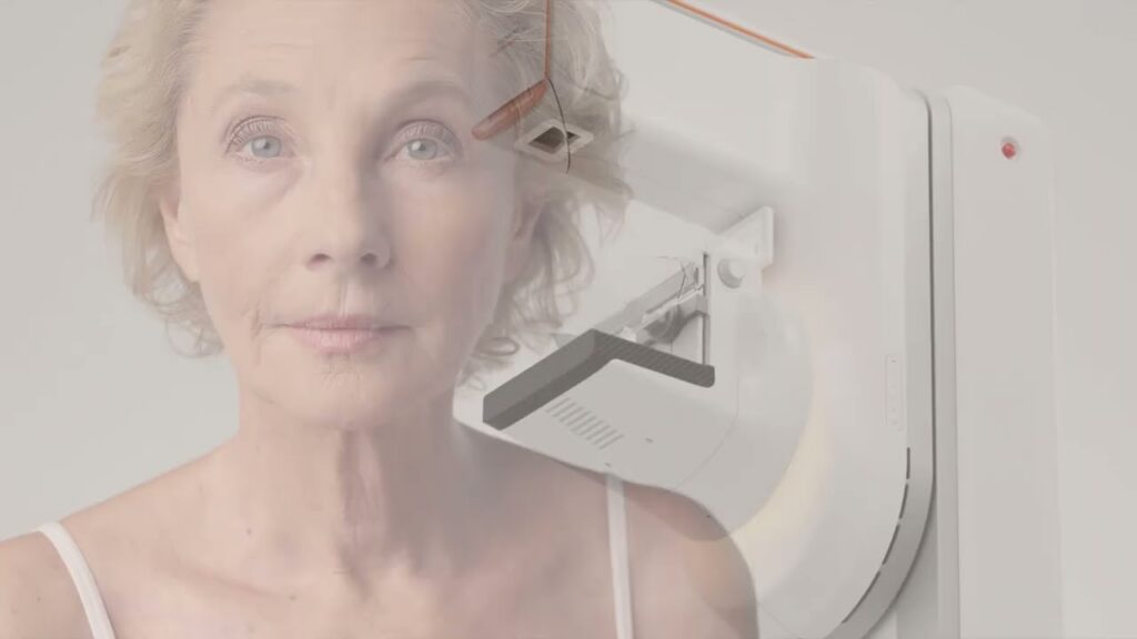 Siemens Healthineers amplía las capacidades de mamografía y biopsia con contraste de Mammomat B.brilliant