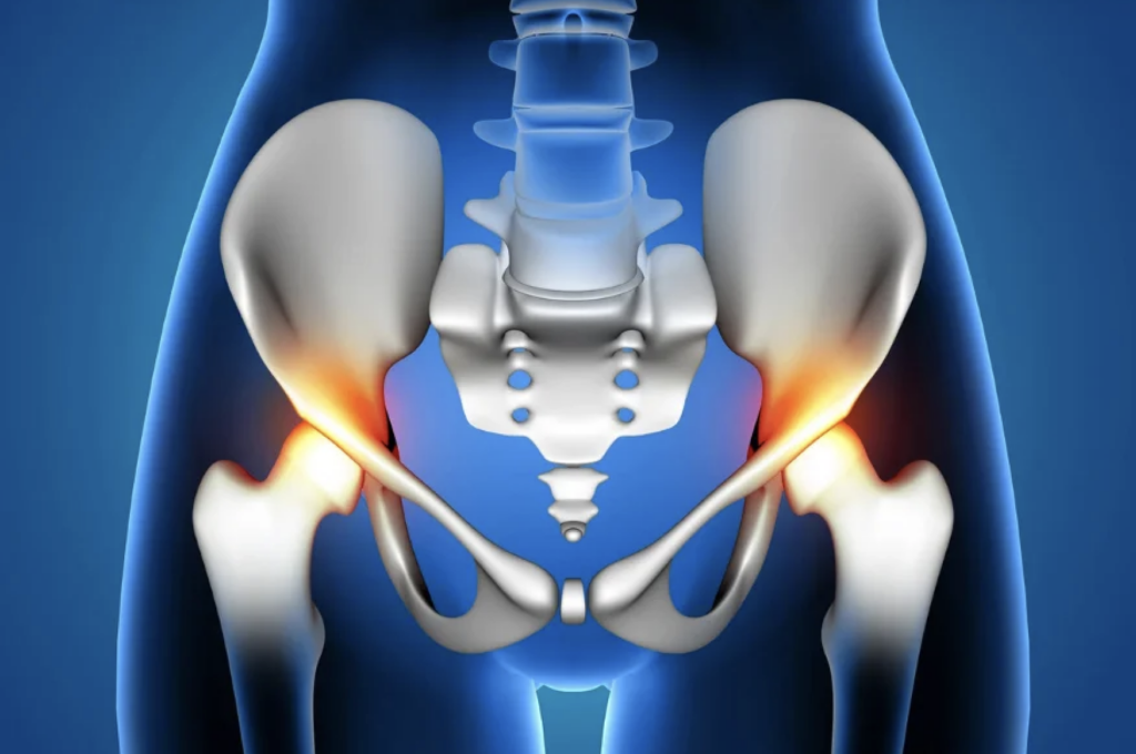 Catching up with Impactor: Driving innovation in hip replacement surgery with ImpacTell’s smart hammer